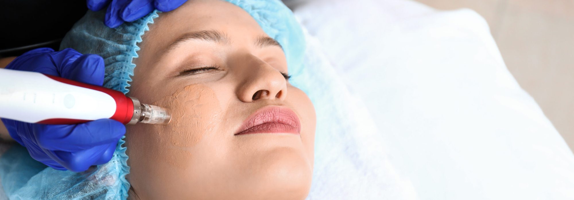 Young,Woman,Undergoing,Procedure,Of,Bb,Glow,Treatment,In,Beauty