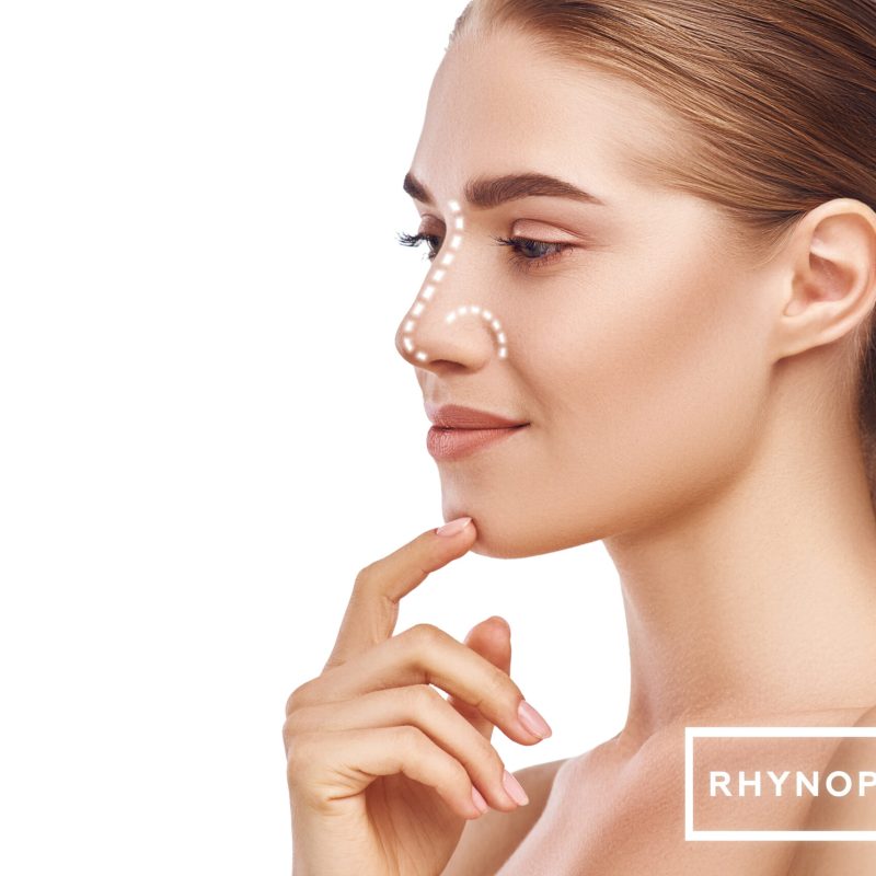 Rhinoplasty,-,Nose,Surgery.,Side,View,Of,Attractive,Young,Woman