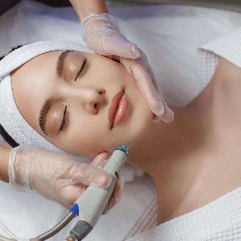 Side,View,Of,Woman,Receiving,Microdermabrasion,Therapy,On,Forehead,At